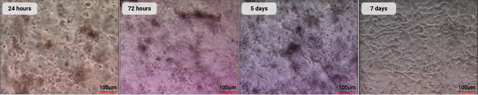 Illustration depicting the angiogenic property of stem cells, aiding in the repair and regeneration of blood vessels, thereby restoring the function of the blood circulation system.